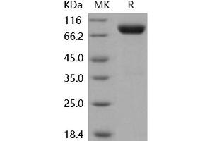 Western Blotting (WB) image for Interleukin 2 Receptor, gamma (IL2RG) (Active) protein (His tag,Fc Tag) (ABIN7320413)