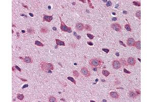 Immunohistochemistry (IHC) image for anti-T-Box Brain Gene 1 (TBR1) (N-Term) antibody (ABIN2779899) (TBR1 抗体  (N-Term))