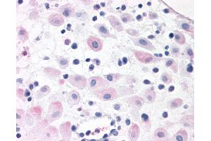 Anti-BRS3 antibody IHC of human pregnant uterus. (BRS3 抗体  (N-Term))