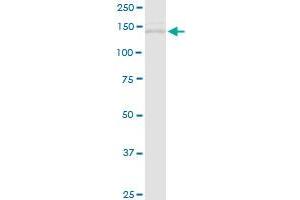 TIMELESS MaxPab rabbit polyclonal antibody. (TIMELESS 抗体  (AA 1-1208))