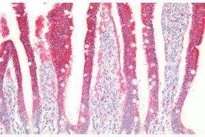 Detection of MST in Human Small intestine Tissue using Polyclonal Antibody to 3-Mercaptopyruvate Sulfurtransferase (MST) (MPST 抗体  (AA 68-278))