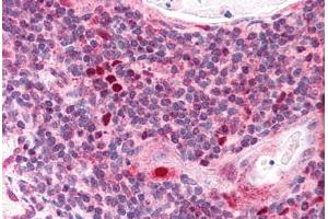 Human Thymus (formalin-fixed, paraffin-embedded) stained with AIRE antibody ABIN291034 at 2. (AIRE 抗体  (AA 534-545))