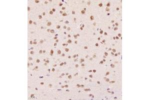 Immunohistochemistry of paraffin embedded mouse brain using SR140 (ABIN7076091) at dilution of 1:1000 (400x lens) (SR140 抗体)