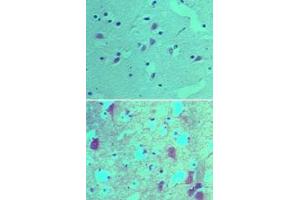 Image no. 1 for anti-SRY (Sex Determining Region Y)-Box 1 (SOX1) (AA 100-150) antibody (ABIN960348) (SOX1 抗体  (AA 100-150))