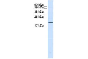 Western Blotting (WB) image for anti-Sodium Channel, Voltage-Gated, Type III, beta Subunit (SCN3B) (N-Term) antibody (ABIN2780215)