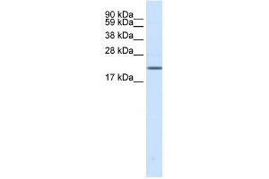 WB Suggested Anti-SCN3B Antibody Titration: 0. (SCN3B 抗体  (N-Term))