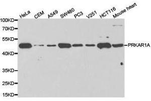 Western Blotting (WB) image for anti-Protein Kinase, CAMP-Dependent, Regulatory, Type I, alpha (Tissue Specific Extinguisher 1) (PRKAR1A) antibody (ABIN1874285)