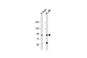 All lanes : Anti-CCDC144A Antibody (C-Term) at 1:2000 dilution Lane 1: human brain lysate Lane 2: HL-60 whole cell lysate Lysates/proteins at 20 μg per lane. (CCDC144A 抗体  (AA 1257-1289))