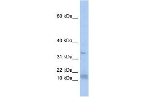 WB Suggested Anti-SF3B14 Antibody Titration:  0. (Pre-mRNA Branch Site Protein p14 (SF3B14) (N-Term) 抗体)