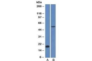 Western blot analysis A) partial recombinant protein B) human stomach lysate using E-Cadherin antibody (CDH1/1525). (E-cadherin 抗体)