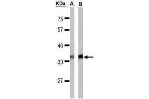 WB Image Sample(30 μg of whole cell lysate) A:MOLT4 , B:Raji , 15% SDS PAGE antibody diluted at 1:1000 (FFAR1 抗体  (C-Term))