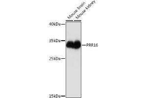 Western blot analysis of extracts of various cell lines, using PRR16 Rabbit pAb (ABIN7269554) at 1:1000 dilution. (PRR16 抗体  (AA 50-150))