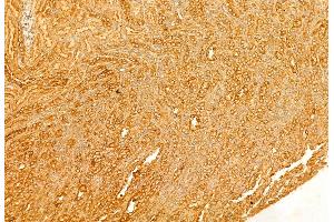 ABIN6259922 and ABIN6269089 at 1/100 staining Rat kidney tissue by IHC-P.
