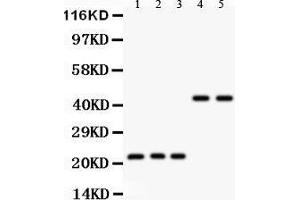 Anti- GPX1 antibody, Western blotting All lanes: Anti GPX1  at 0. (Glutathione Peroxidase 1 抗体  (Middle Region))