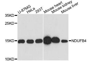 Western blot analysis of extracts of various cell lines, using NDUFB4 antibody. (NDUFB4 抗体  (AA 1-90))