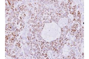 IHC-P Image Immunohistochemical analysis of paraffin-embedded A549 xenograft, using Creatine kinase 1B, antibody at 1:300 dilution. (CKMT1B 抗体)