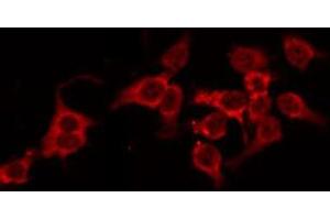 ABIN6268739 staining HeLa by IF/ICC. (Cathepsin D 抗体  (C-Term))