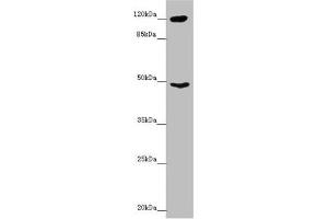 Western blot All lanes: INPP4A antibody at 8. (INPP4A 抗体  (AA 1-250))