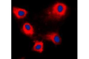 Immunofluorescent analysis of ARFIP1 staining in HeLa cells. (ARFIP1 抗体  (C-Term))