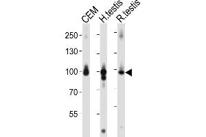 Western blot analysis of lysates from CEM cell line, human testis, rat testis tissue lysate (from left to right), using AC Antibody (C-term) 1151a. (Centaurin beta 2 抗体  (C-Term))