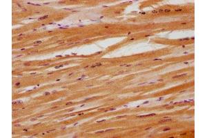 IHC image of ABIN7160584 diluted at 1:100 and staining in paraffin-embedded human heart tissue performed on a Leica BondTM system. (MYH6 抗体  (AA 894-1132))