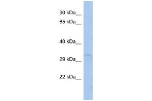 WB Suggested Anti-TOMM40L Antibody Titration:  0.