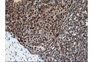 Image no. 5 for anti-Pyridoxal Kinase (PDXK) antibody (ABIN1500145)