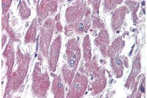 Human Heart (formalin-fixed, paraffin-embedded) stained with GPR116 antibody ABIN399995 at 10 ug/ml followed by biotinylated goat anti-rabbit IgG secondary antibody ABIN481713, alkaline phosphatase-streptavidin and chromogen. (G Protein-Coupled Receptor 116 抗体  (Internal Region))