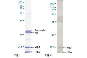 Kinase Activity Assay (KAA) image for V-Raf Murine Sarcoma 3611 Viral Oncogene Homolog (ARAF) (AA 1-606) protein (GST tag) (ABIN1345430) (ARAF Protein (AA 1-606) (GST tag))