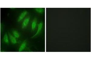 Immunofluorescence analysis of HeLa cells, using HEXIM1 Antibody. (HEXIM1 抗体  (AA 181-230))