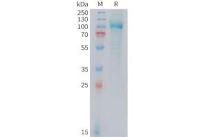 Folate Hydrolase (Prostate-Specific Membrane Antigen) 1 (FOLH1) (AA 45-752) protein (His tag)