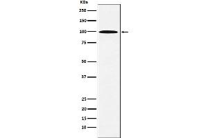 Western blot analysis of AP1G1 expression in 293T cell lysate. (Recombinant gamma 1 Adaptin 抗体)