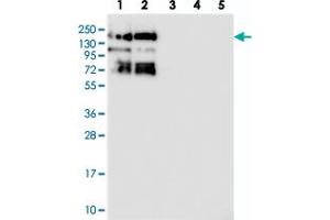 Western blot analysis of Lane 1: RT-4, Lane 2: U-251 MG, Lane 3: Human Plasma, Lane 4: Liver, Lane 5: Tonsil with SBNO1 polyclonal antibody  at 1:250-1:500 dilution.
