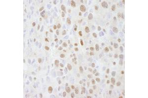 Immunohistochemistry (IHC) image for anti-SWI/SNF Related, Matrix Associated, Actin Dependent Regulator of Chromatin, Subfamily C, Member 2 (SMARCC2) (C-Term) antibody (ABIN7448801)