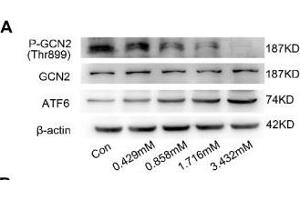 Western Blotting (WB) image for anti-Actin, beta (ACTB) antibody (ABIN3020544)