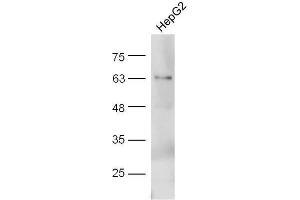 Western Blotting (WB) image for anti-Adiponectin (ADIPOQ) (AA 151-244) antibody (ABIN669051)