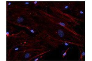 Immunofluorescence (IF) image for anti-Actin, beta (ACTB) antibody (ABIN2664066) (beta Actin 抗体)