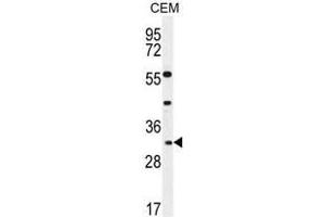 APOF Antibody (Center) western blot analysis in CEM cell line lysates (35µg/lane). (Apolipoprotein F 抗体  (Middle Region))