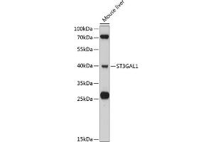 Western blot analysis of extracts of mouse liver, using ST3G antibody (ABIN6130190, ABIN6148520, ABIN6148522 and ABIN6215305) at 1:3000 dilution. (ST3GAL1 抗体  (AA 35-135))