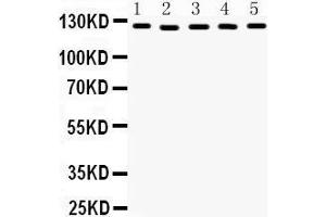 Western Blotting (WB) image for anti-Damage Specific DNA Binding Protein 1 (DDB1) (AA 1011-1140) antibody (ABIN3043823) (DDB1 抗体  (AA 1011-1140))
