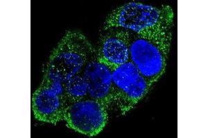 Immunofluorescence (IF) image for anti-Collagen, Type VIII, alpha 2 (COL8A2) (AA 578-607), (C-Term), (Chain alpha 2) antibody (ABIN951626)