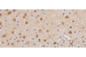 Immunohistochemistry of paraffin-embedded Mouse brain using MAP2K6 Polyclonal Antibody at dilution of 1:50 (MAP2K6 抗体)