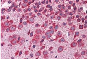 Mouse Brain: Formalin-Fixed, Paraffin-Embedded (FFPE) (FBXW7 抗体  (AA 251-300))