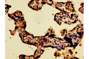 Immunohistochemistry (IHC) image for anti-WW Domain Containing Oxidoreductase (WWOX) (AA 1-180) antibody (ABIN7175871)