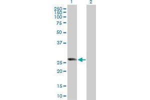 Western Blot analysis of RABL2B expression in transfected 293T cell line by RABL2B MaxPab polyclonal antibody. (RABL2B 抗体  (AA 1-229))
