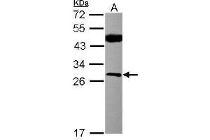 WB Image Sample (30 ug of whole cell lysate) A: MCF-7 12% SDS PAGE antibody diluted at 1:500 (CSNK2B 抗体)