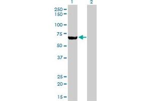 Western Blot analysis of MTMR2 expression in transfected 293T cell line by MTMR2 monoclonal antibody (M03), clone 4G6. (MTMR2 抗体  (AA 5-100))