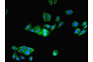 Immunofluorescent analysis of HepG2 cells using ABIN7164206 at dilution of 1:100 and Alexa Fluor 488-congugated AffiniPure Goat Anti-Rabbit IgG(H+L) (PFDN1 抗体  (AA 2-122))