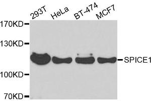 Western blot analysis of extracts of various cells, using SPICE1 antibody. (SPICE1 抗体)