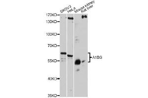 Western blot analysis of extracts of various cell lines, using A1BG antibody. (A1BG 抗体)